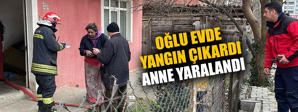 Oğlunun evde çıkardığı yangını söndüren kadın yaralandı