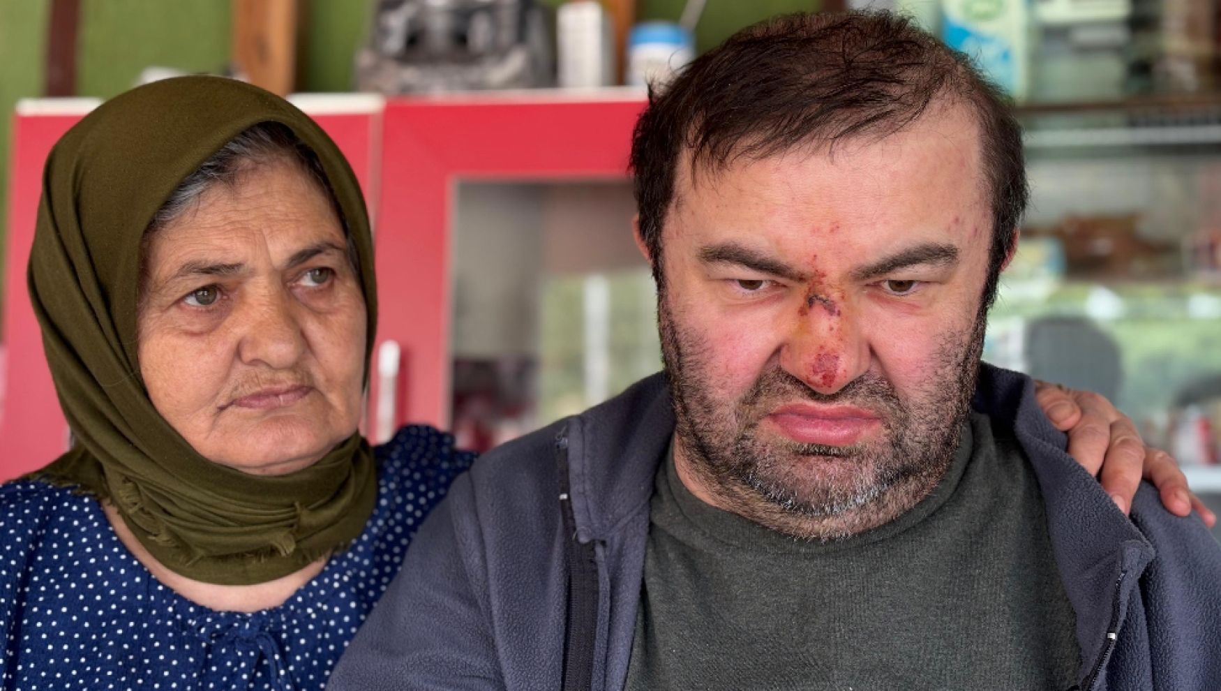 Yüzde 90 engelli vatandaşın acımasızca darp edildiği iddiası var