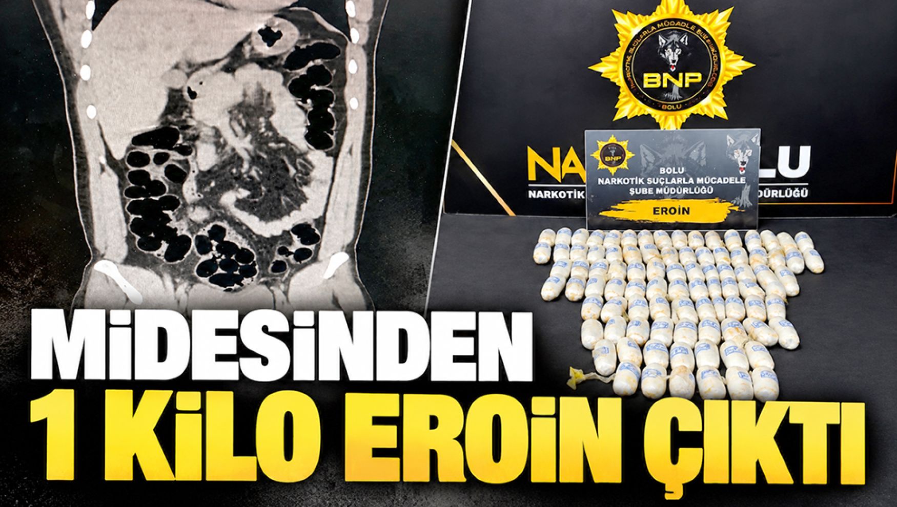 Midesinde 89 kapsül eroinle yola çıktı! Yolculuk cezaevinde bitti